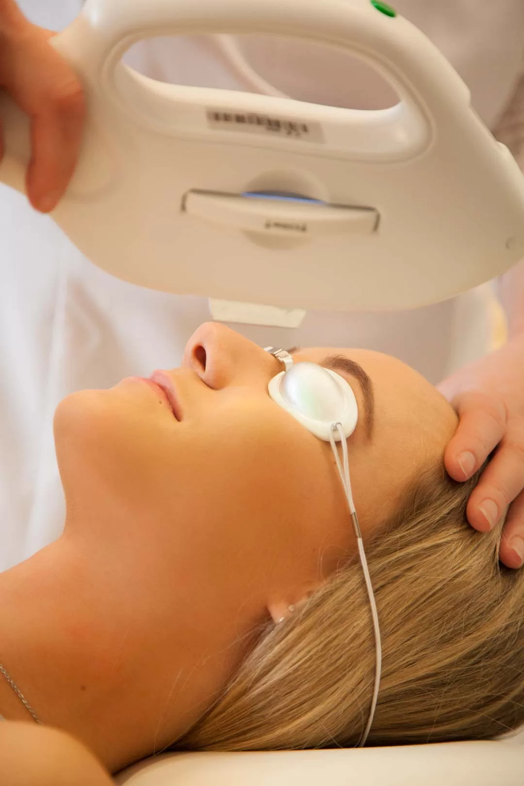 Photorejuvenation treatment for the skin